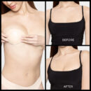 Subtle Lift Inserts